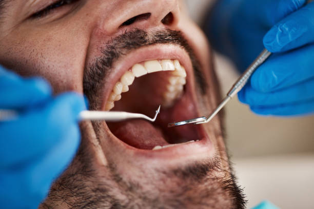 Best Tooth Infection Emergency Dentist  in Lecanto, FL